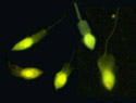 Choanoflagellaten im Fluoreszenzmikroskop. (M. E. Sieracki, Bigelow Lab. f. Ocean Sciences)