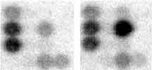 Genexpression bei Schimpanse (links) und Mensch (rechts): Je größer die Menge an Boten-RNA, desto schwärzer der Fleck. (Bild: MPG)