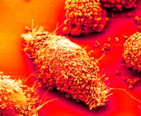 Zahlreiche Neisserien, die Erreger der Gonorrhoe, auf Epithelzellen. Bild: MPG