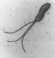 Helicobacter pylori ist vermutlich für die meisten Fälle von Magengeschwüren und Magenkrebs verantwortlich.