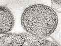 Ein “Reitender Urzwerg” an der Oberfläche eines Ignococcus im Lichtmikroskop