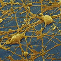 Über feine Arme, die Axone, stehen Nervenzellen untereinander in Kontakt. So können sie auch Signale von Computerchips aufnehmen.