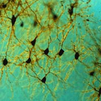 Jede Nervenzelle im Gehirn hat etwa 10000 Verbindungen zu anderen Zellen. Bilder: MPG